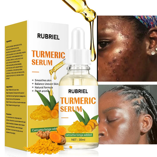 Turmeric Face Serum 30ml Anti Aging Wrinkle Fine Line Dark Spot Remover